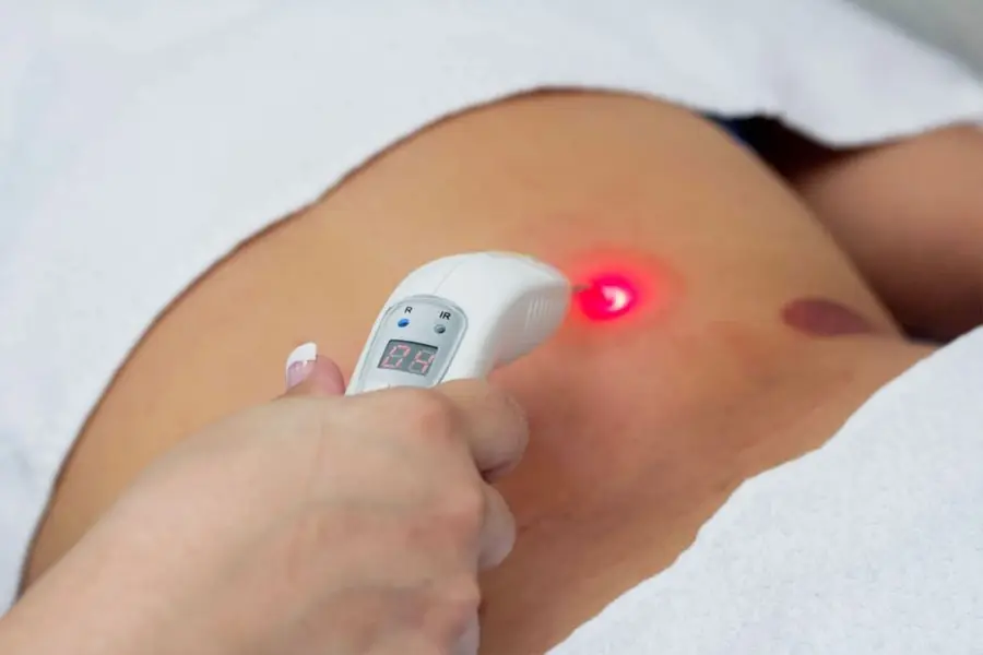 Aplicação de laser terapêutico